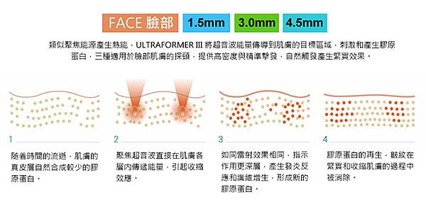 海芙音波拉提第三代ULTRAFORMER III – 髮拉儷01.jpg