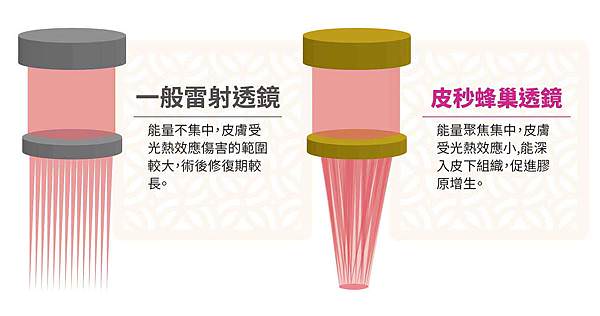皮秒雷射蜂巢透鏡探頭.jpg