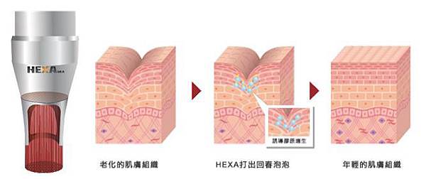 PICOCARE皮秒雷射探頭手把-雅文診所.JPG