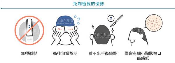 免剃植髮的優勢.jpg