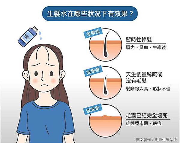 生髮水的效果-毛爵生髮診所.jpg