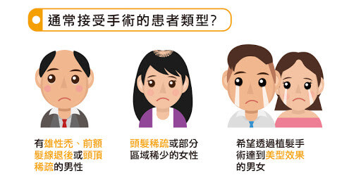 什麼樣的人需要植髮手術.jpg