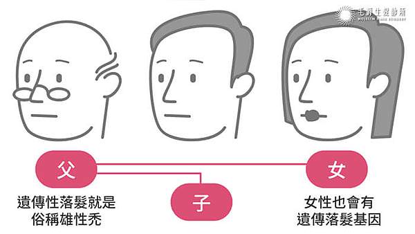 我是不是有雄性禿-毛爵.jpg