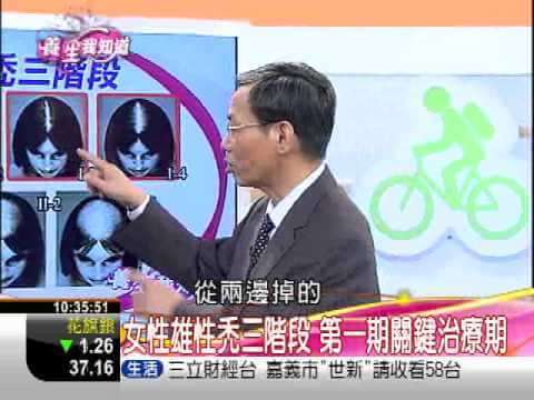 女性雄性禿的黃金治療期-三立.jpg