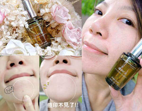 婕洛妮絲藜麥抗痘精華｜痘痘痕跡不要來1.jpg