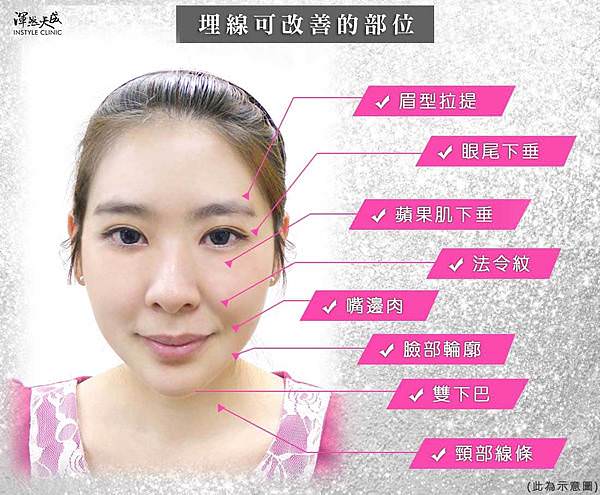 線雕拉提可以改善的部位-渾然天成.jpg