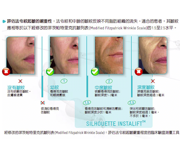 線雕拉提的術前評估不同肌膚鬆弛程度-米蘭診所1.png