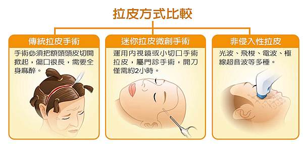 拉皮方式比較-全民健康基金會.jpg