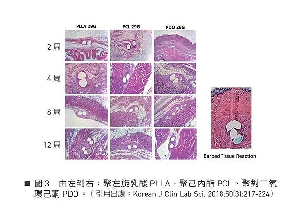 線雕拉效果-組織膠原新生圖-關鍵評論網.jpg
