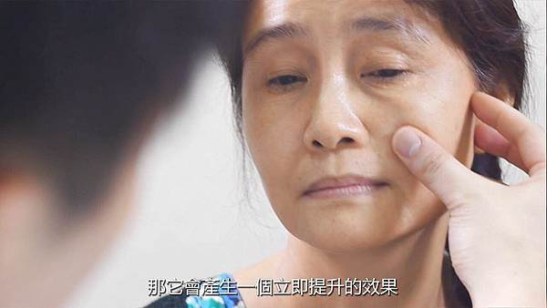 詩立愛塑型線埋線拉提-教主整形外科.jpg