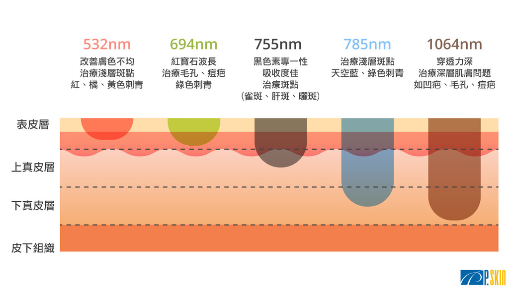 皮秒雷射價格,皮秒雷射波長