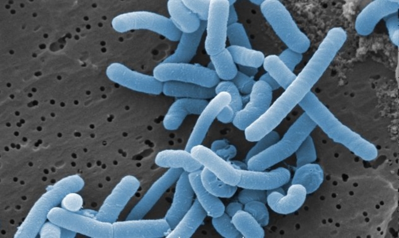 Probiotics640px Lactobacillus paracasei
