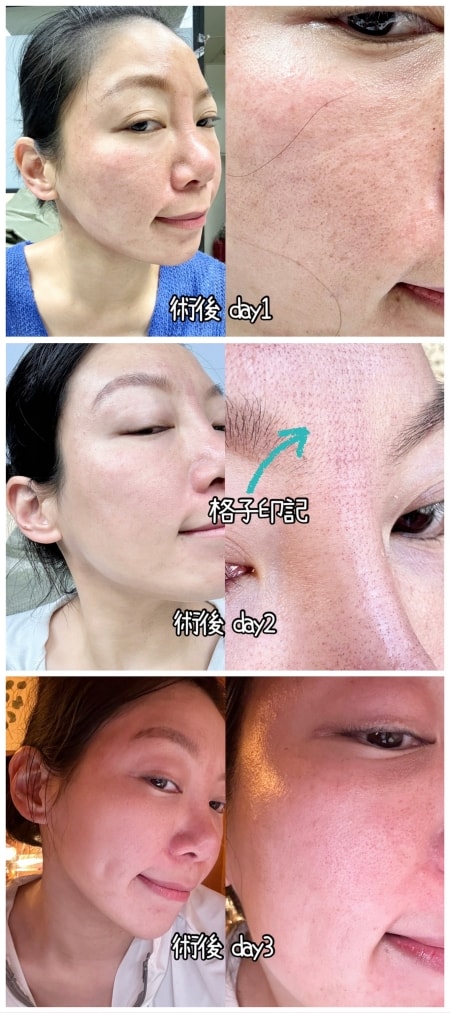 時空e電波恢復期