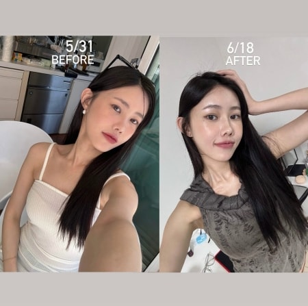 麗珠蘭dcard論戰?麗珠蘭注射台灣不合法,2024年底合法引進的保養型麗珠蘭水光差別在哪? - 第11張圖