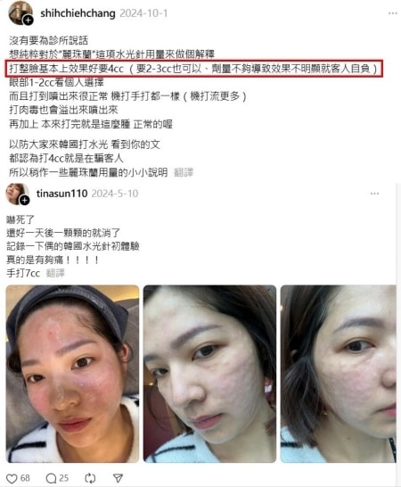 麗珠蘭dcard論戰?麗珠蘭注射台灣不合法,2024年底合法引進的保養型麗珠蘭水光差別在哪? - 第4張圖 麗珠蘭dcard論戰功效