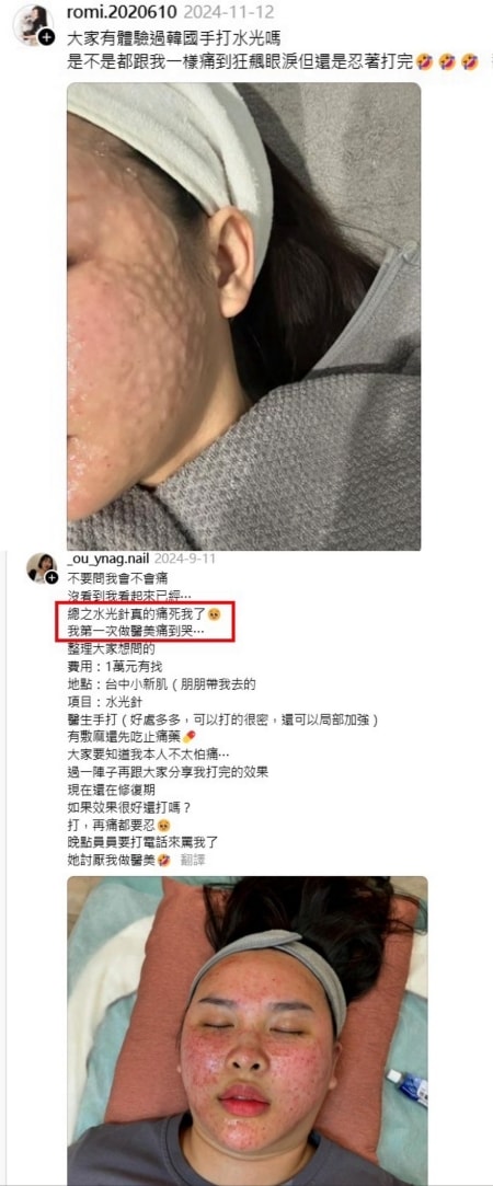 麗珠蘭dcard論戰?麗珠蘭注射台灣不合法,2024年底合法引進的保養型麗珠蘭水光差別在哪? - 第16張圖 麗珠攔dcard