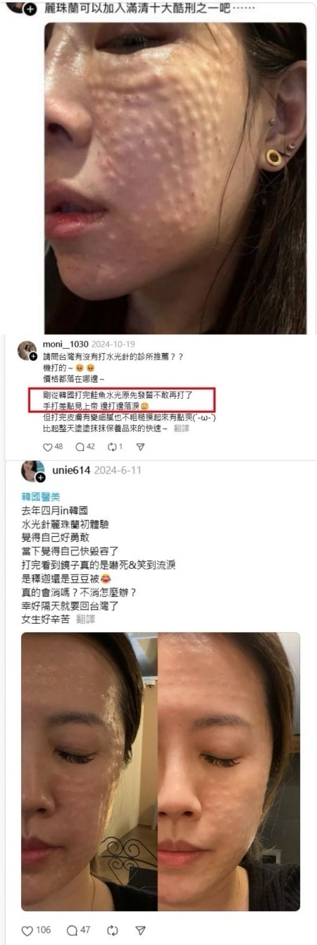 麗珠蘭dcard論戰?麗珠蘭注射台灣不合法,2024年底合法引進的保養型麗珠蘭水光差別在哪? - 第14張圖 麗珠攔dcard