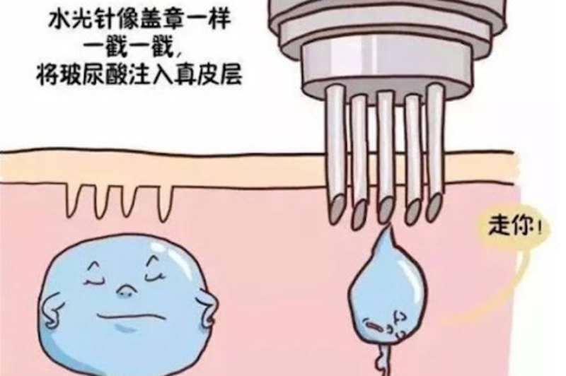 水光針多久打一次