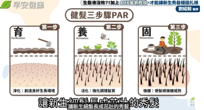 髮利明有效嗎?髮利明AHK藍銅髮根噴劑1天1次,連續使用6週實測,髮際線密度真的回來了! - 第8張圖 髮利明有效嗎,髮利明AHK藍銅髮根滋養噴劑