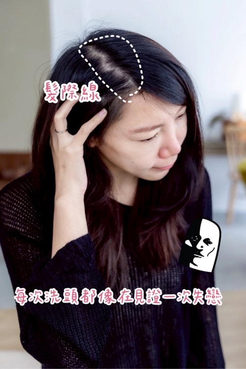 髮利明有效嗎?髮利明AHK藍銅髮根噴劑1天1次,連續使用6週實測,髮際線密度真的回來了! - 第5張圖 髮利明有效嗎,髮利明AHK藍銅髮根滋養噴劑