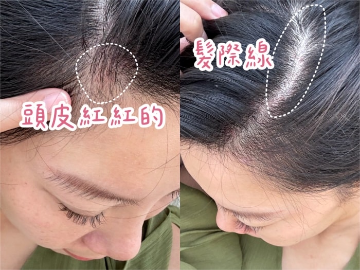 髮利明有效嗎?髮利明AHK藍銅髮根噴劑1天1次,連續使用6週實測,髮際線密度真的回來了! - 第6張圖 髮利明有效嗎,髮利明AHK藍銅髮根滋養噴劑