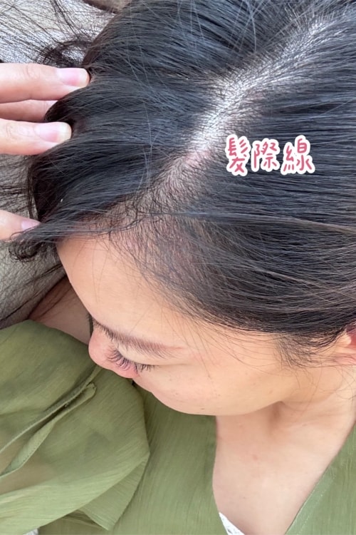 髮利明有效嗎?髮利明AHK藍銅髮根噴劑1天1次,連續使用6週實測,髮際線密度真的回來了! - 第35張圖 髮利明有效嗎,髮利明AHK藍銅髮根滋養噴劑