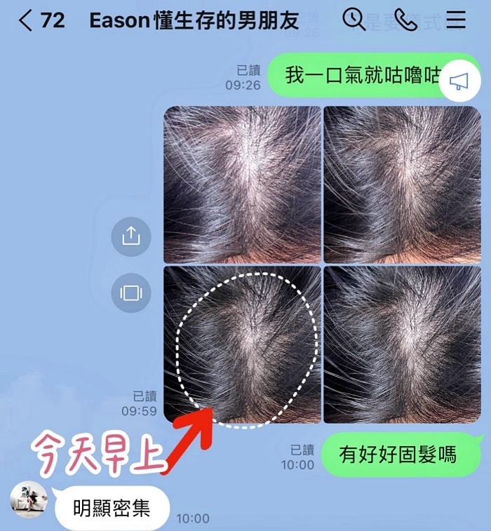 髮利明有效嗎?髮利明AHK藍銅髮根噴劑1天1次,連續使用6週實測,髮際線密度真的回來了! - 第33張圖 髮利明有效嗎,髮利明AHK藍銅髮根滋養噴劑