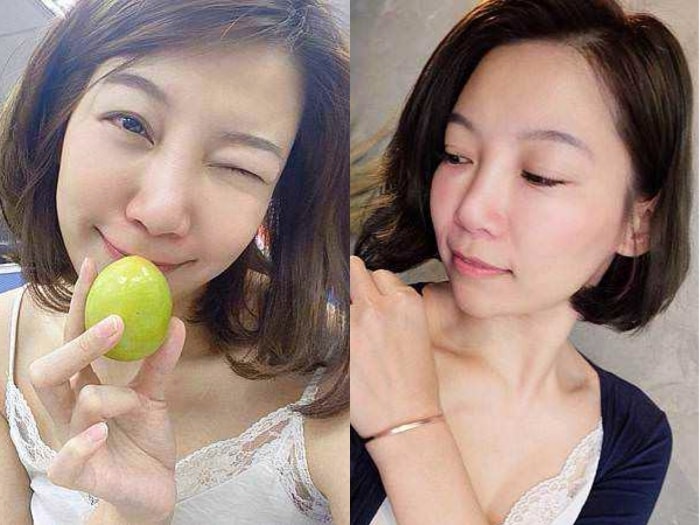 髮利明有效嗎?髮利明AHK藍銅髮根噴劑1天1次,連續使用6週實測,髮際線密度真的回來了! - 第3張圖 髮利明有效嗎,髮利明AHK藍銅髮根滋養噴劑