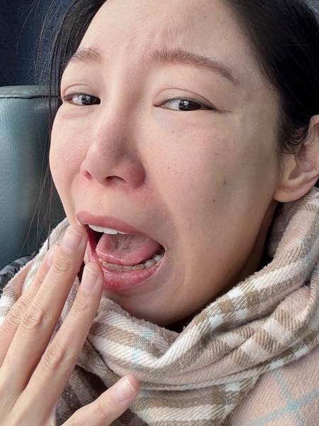 嘴巴味道怪怪的？益口香益生菌1天3包，清新整天贏過口香糖！