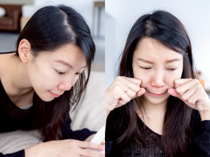 髮利明有效嗎?髮利明AHK藍銅髮根噴劑1天1次,連續使用6週實測,髮際線密度真的回來了! - 第36張圖 髮利明有效嗎,髮利明AHK藍銅髮根滋養噴劑