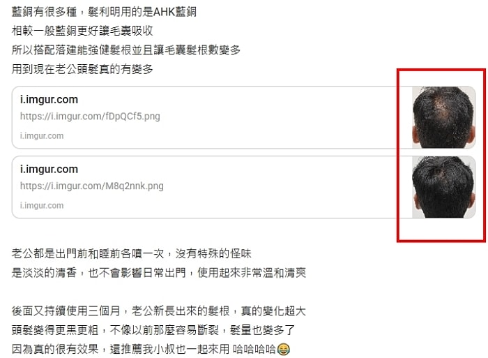 髮利明有效嗎?髮利明AHK藍銅髮根噴劑1天1次,連續使用6週實測,髮際線密度真的回來了! - 第45張圖 髮利明有效嗎,髮利明AHK藍銅髮根滋養噴劑