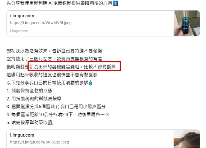 髮利明有效嗎?髮利明AHK藍銅髮根噴劑1天1次,連續使用6週實測,髮際線密度真的回來了! - 第44張圖 髮利明有效嗎,髮利明AHK藍銅髮根滋養噴劑