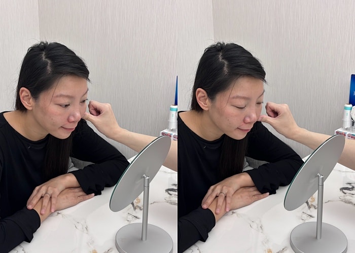 新願美學診所評價,蘇摸摸