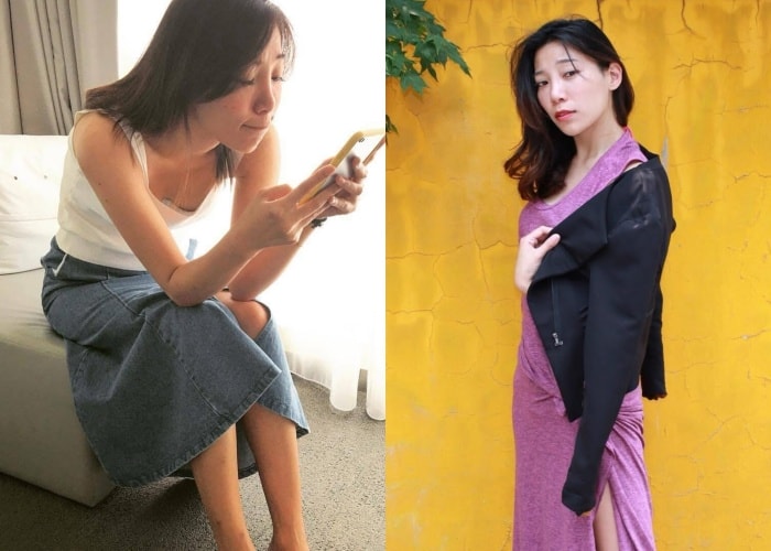 法令紋醫美,新願美學診所11