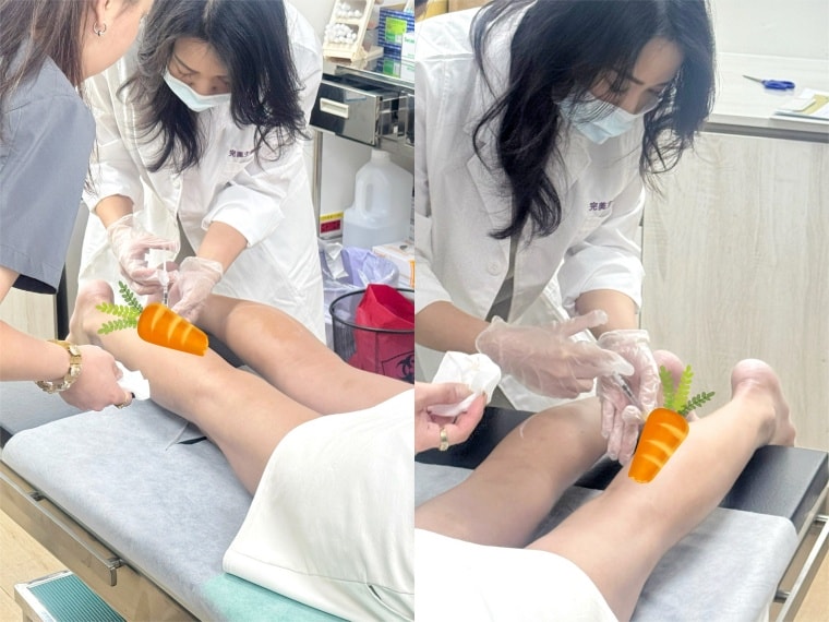 奇蹟肉毒小腿實測|完美主義美學診所評價、費用與術後記錄:2~3週消滅蘿蔔腿! - 第28張圖 完美主義美學診所LINE ALBUM 肉毒小腿 260428