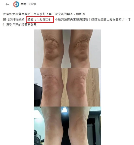 彈力針dcard,彈力針效果