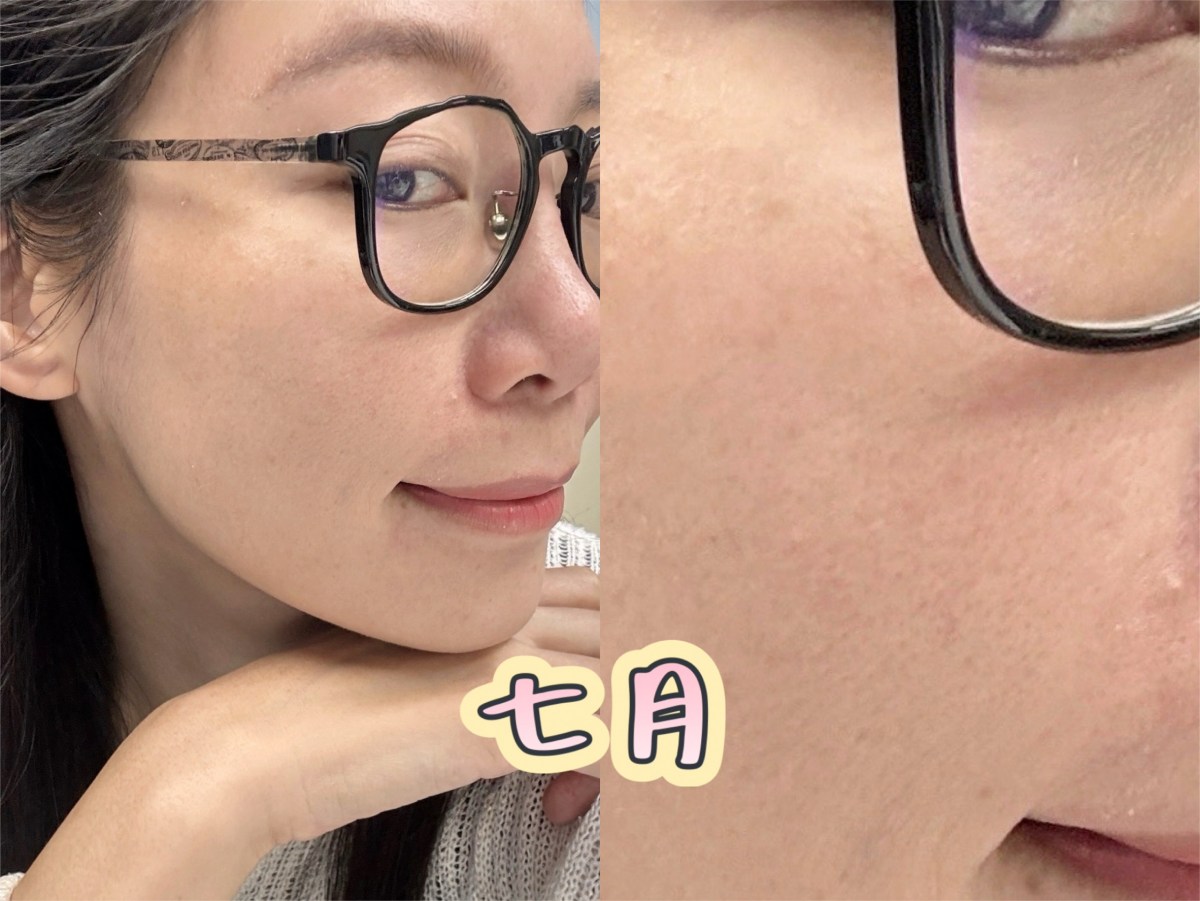 彈力針效果,彈力針逆時針差別,蘇摸摸