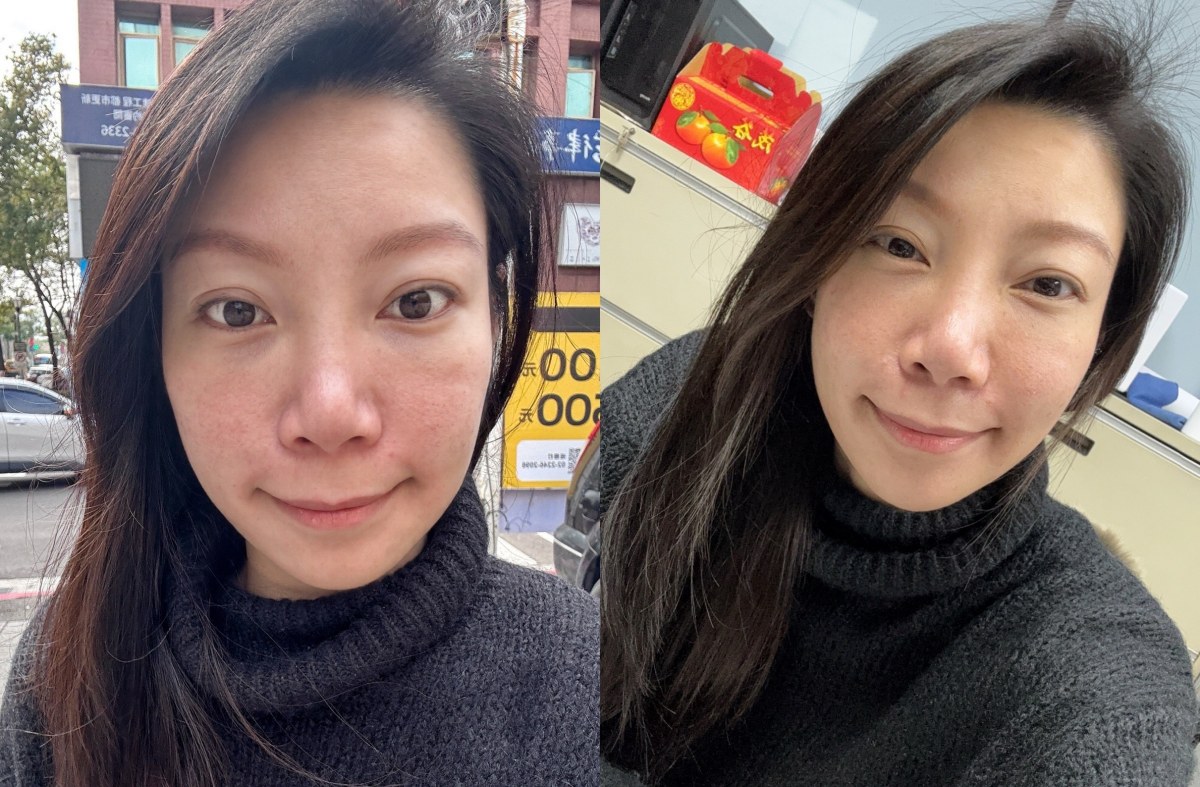 新願美學診所評價,新願美學診所dcard,新願美學,蘇摸摸