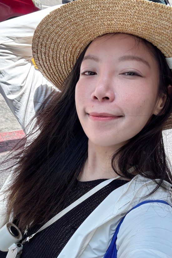新願美學診所評價,新願美學診所dcard,新願美學診所術後2個月,蘇摸摸