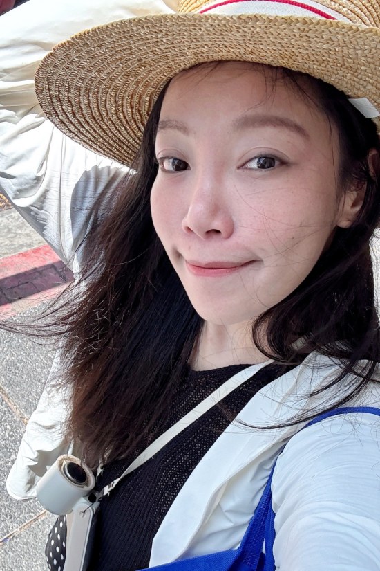 新願美學診所評價,新願美學診所dcard,新願美學診所術後2個月,蘇摸摸1